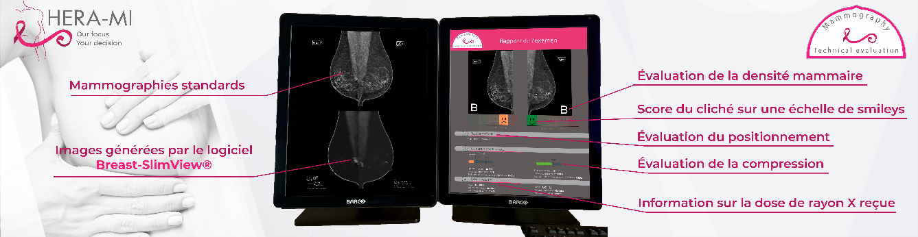 MTE mammography technical evaluation manipulateur radio cliches techniquement insuffisants